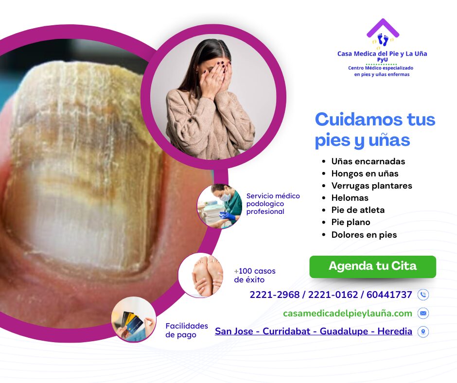 clínica del pie especializada en Costa Rica cuidado del pie diabético en San José tratamiento para uñas enfermas en Guadalupe prevención de úlceras diabéticas en clínica podológica podología para pacientes diabéticos en Costa Rica curación de heridas en pies diabéticos con láser atención integral para pies y uñas enfermas clínica podológica en Guadalupe especializada en diabetes control del pie diabético con especialistas en 2025 prevención de amputación diabética en clínica del pie