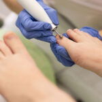 tatamiento de l pie diabetico