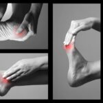 DOLOR-EN-EL-PIE-FASCITIS-PLANTA CASA MEDICA DEL PIE Y LA UÑA , CLINICA DEL DOLOR